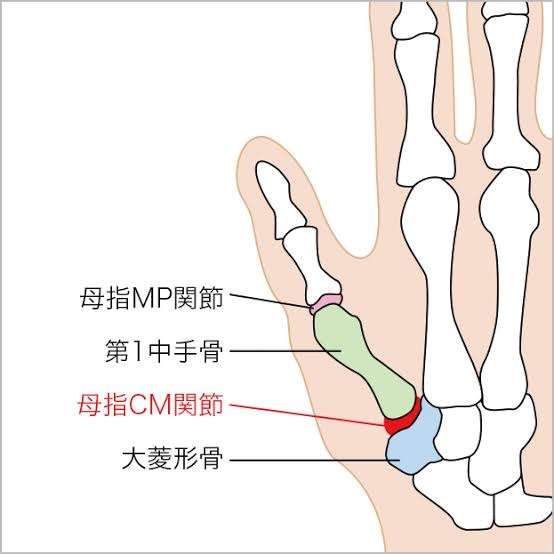 親指を動かすと痛い　母指ｃｍ関節症|表参道リテアス　整体　新リンパ療法